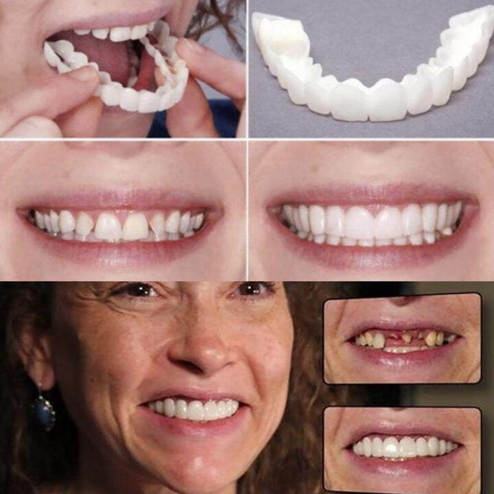 1 pairs false teeth instant snap on Smile top bottom cover toothless