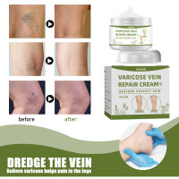 Eelhoe Vein Massage Varicose Vein Cream  Soothe Veins and Smoothes Worm Legs Varicose Vein Cream  Pain Swelling Blood Vessels