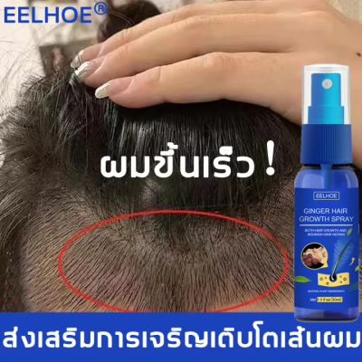 บอกลาหัวล้าน EELHOE น้ำยาปลูกผม 30ml สเปรย์ปปลูกผม สำหรับผมบาง น้ำยาใส่ผม หัวล้าน ผมบาง น้ำยาปลูกผมชาย สเปรย์ปลูกผม เร่งผมยาว เซรั่มบำรุงผม น้ำยาเร่งผมยาว เร่งผมขึ้นใหม่ เซรั่มปลูกผม ป้องกันผมร่วง ปลูกผมเร่งด่วน Hair Serum