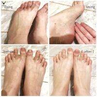 sp 110ML Foot Peeling Spray Elbow Exfoliating Essence Pedicure Cosmetics for Dead Skin