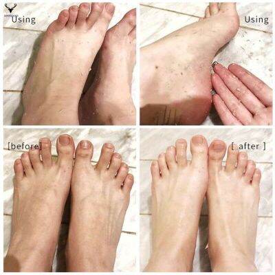 sp 110ML Foot Peeling Spray Elbow Exfoliating Essence Pedicure Cosmetics for Dead Skin