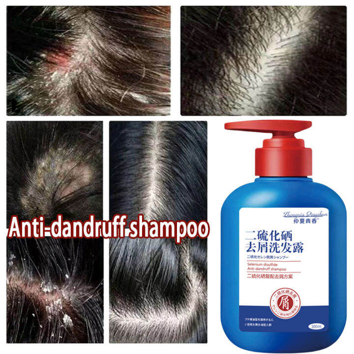 Shampoo Kelemumur Anti Dandruff Shampoo Scalp Treatment Hair Treatment