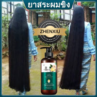 แชมพูขิง ZHENXIU แชมพูแก้ผมร่วง ยาสระผมขิงแท้ ขิงซึมถึงราก สดชื่นคุมมัน รากผมแข็งแรง ผมไม่เสียอีกต่อไป แชมพูสมุนไพร แชมพูปลูกผม ยาสระผมสำหรับผมเสีย Ginger Shampoo