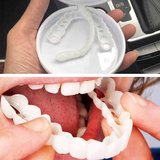 Beautybigbang niềng răng nhân tạo chăm sóc răng miệng bằng silicon cho làm - ảnh sản phẩm 1
