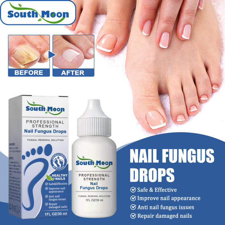 South Moon Anti Fungal Drops Anti Infection Paronychia Onychomycosis ...