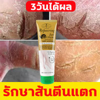 AICHUN ครีมทาส้นทาแตก100ml 3วันได้ผล รักษาส้นตีนแตก ครีมทาส้นเท้าแตก ป้องกันการสูญเสียความชื้นจากผิวเท้า บำรุงผิวและฝ่ามือที่แห้งกร้านให้เนียนนุ่ม ครีมทาเท้าแตก ครีมทาเท้าขาว