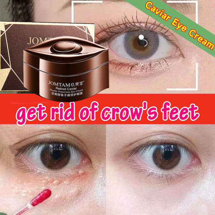 【JOMTAM】Retinol Caviar Eye Cream Removing Dark Circles Removing Eye ...