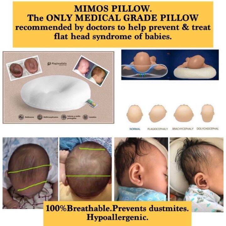 The new 2022 Mimos Pillow is the only medical grade baby pillow to