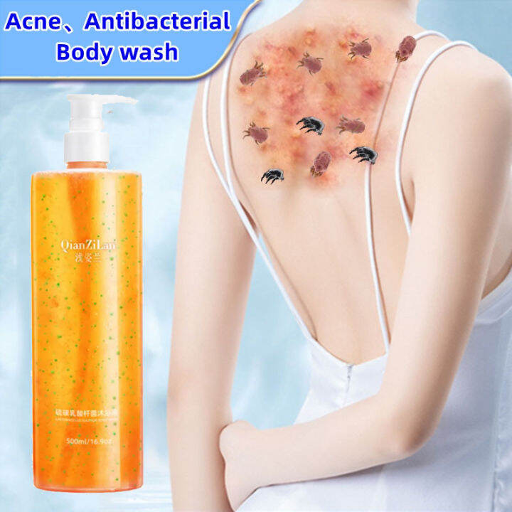 Acne Body Wash Whitening Body Wash Natural Perfume Shower Gel Solve Dry