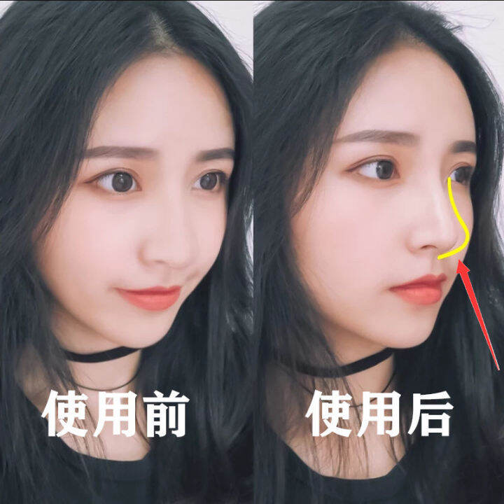 Nose booster reduces nose wing beauty nose artifact thin nose