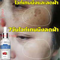 7วันฝ้าจางลง Jaysuing เซรั่มแก้ฝ้า 30ml เซรั่มฝ้ากระ กำจัดฝ้า ฝ้า กระ ป้องกันริ้วรอย ไวท์เทนนิ่งลดฝ้า จุดด่างดำ ซึมซับดี กระจ่างใสผิว เซรั่มหน้าใส เซรั่มหน้าขาวใส ครีมทาฝ้า ครีมรักษาฝ้า ครีมฝ้ากระ ครีมลบฝ้า ครีมแก้ฝ้ากระ