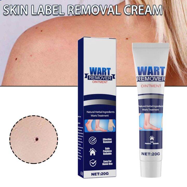 KPL Skin Tag Wart Remover Cream Antibacterial Extract Corn Plaster Wart ...