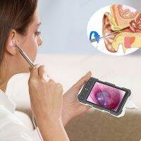 geegostudio 5-Inch Digital Screen Ear Cleaner - 3.9mm 1080P HD Otoscope Scope - Easily Remove Ear Wax - No App Required!