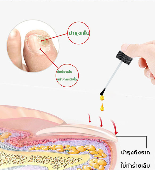 tanksen-เซรั่มบำรุงเล็บ-30ml-ซ่อมเล็บที่ชำรุด-น้ำยาซ่อมแซมเล็บ-น้ำยาแก้ปัญหาเล็บ-ดูแลเล็บ-เซรั่มเล็บ-เซรั่มซ่อมแซมเล็บ-เชื้อราเล็บมือ-สำหรับเชื้อราที่เล็บ-น้ำยาบำรุงเล็บ-เชื้อราเล็บ-เล็บเสีย-แก้ปัญหาเ