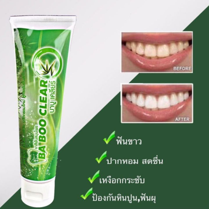 ยาสีฟัน-บาบูเคลียร์-baboo-clear-ยาสีฟันสมุนไพร-ปากสะอาด-ลมหายใจสดชื่น-ลดหินปูนหนา-ลดกลิ่นปากแรง-120-กรัม-หลอด-1-หลอด