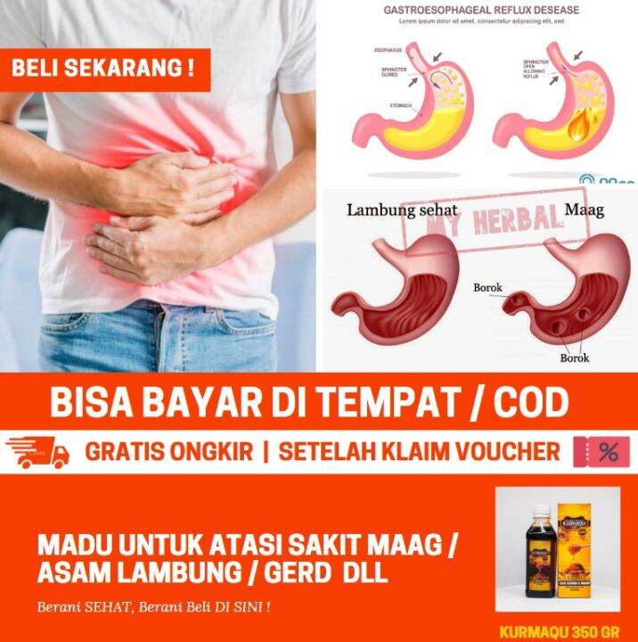 Obat Alami Kram Pada Perut Kram Di Bagian Perut Obat Herbal Keram Otot