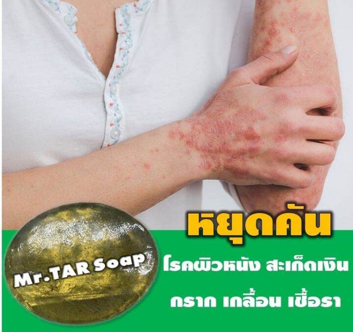 mr-tar-soap-สบู่น้ำมันดิน100กรัมแท้-สูตรอ่อนโยน-สบู่ผิวหนังอักเสบทุกประเภท-สะเก็ดเงิน-ชุดสุดคุ้ม-1-แถม-1-ส่งไว