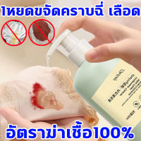 อัตราฆ่าเชื้อ100% น้ำยาซักชุดชั้นใน น้ำยาซักผ้า 520ml ซักชุดชั้นใน กางเกงใน อ่อนโยน ขจัดคราบเหงื่อไคล คราบเลือด ลดอาการเหลือง ราน้ำค้าง ฆ่าเชื้อแบคทีเรีย น้ำยาซักผ้าหอม ผลิตภัณฑ์ทำความสะอาดชุดชั้นใน น้ำยาซักชั้นใน น้ำยาซักชุดชั้นใน ขวด น้ำยาชักชุดชั้นใน