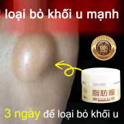 Kem tan u mỡ,Tan u cứng U mỡ, khối u tuyến giáp 30g Kem tan u mỡ loại bỏ u