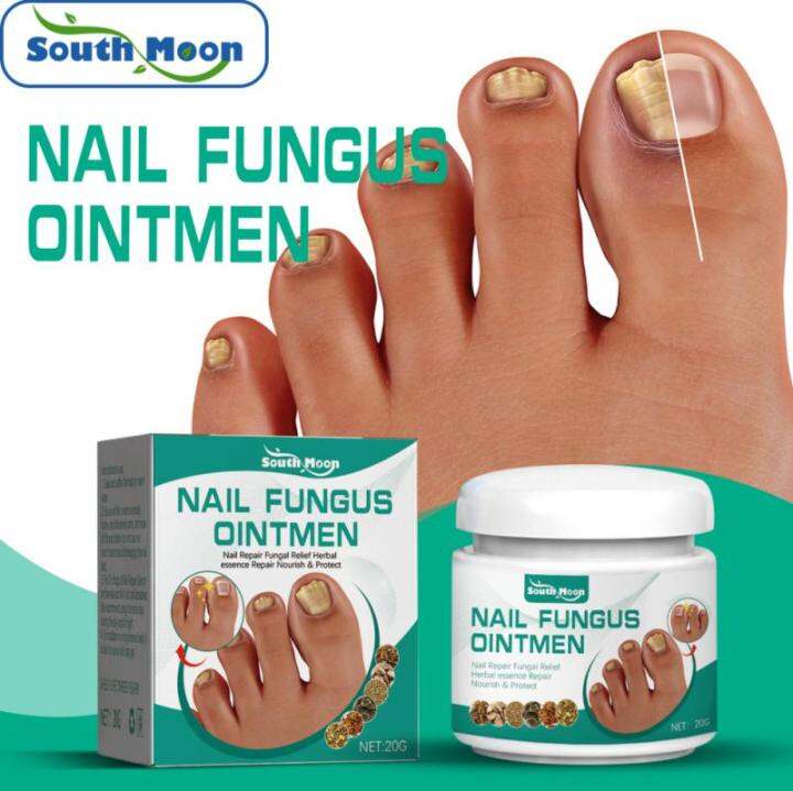 Onychomycosis Paronychia Care Nail Care Ointment Anti Fungal Nail Cream ...