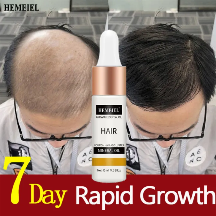 ⚡thicker Hair In 7 Days⚡hair Serum Hair Grower Fast Long Hair Treatment