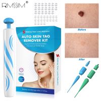 【CW】┅❅  Painless Tag Remover Device Safe Removal Mole Scarless Corn Wart Acne Tools