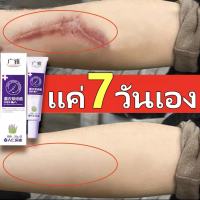 ?7วัน เห็นผล? GUANGYA ครีมลบแผลเป็น 20g ครีมลบรอยแผลเป็น บรรเทารอยแผลเป็นจากการผ่าตัด แผลไหม้ รอยขีดข่วน เร่งการซ่อมแซมให้ผิว ครีมลดรอยแผลเป็น ครีมทาแผลเป็น ครีม ครีมกำจัดรอยแผลเป็น Scar cream