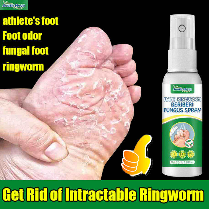 South Moon Anti Fungal Athlete Foot Spray 30ml Relieve Beriberi Toe Treatment Anti Sweat Anti
