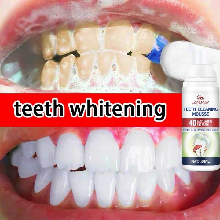 Hotduanp Teeth Whitening Mousse Tooth Cleaning Whitening Toothpaste
