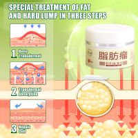 Lipoma Removal Cream Special Gel Removing Multiple Single Lipoma Subcutaneous Lipoma Lump Bulge