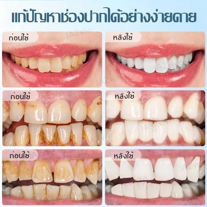 ยาสีฟัน-ยาสีฟันไวท์เทนนิ่ง-ฟอกฟันขา-ลดกลิ่นปาก-ลมหายใจ-หอมสดชื่น-100g