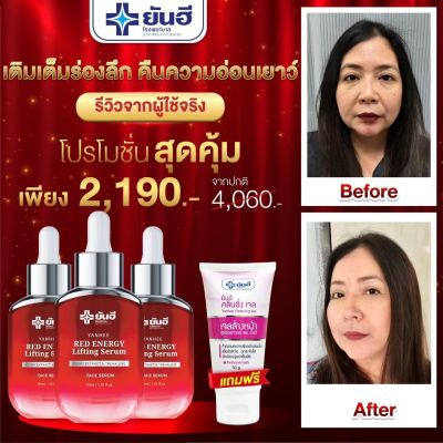 ของแท้จากแบรนด์ ยันฮีเรดเซรั่ม Yanhee Red Energy Lifting Serum ขนาด 30 ML 3 ขวด แถมฟรียันฮี คลีนซิ่ง เจล พร้อมส่ง จัดส่งเร็ว✅✅