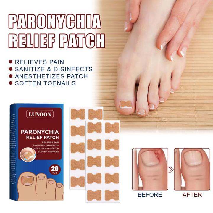 20 Pcs Foot Paronychia Care Stickers Toe Nail Care Abscess Embedded and ...