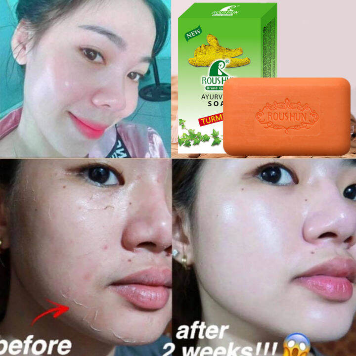 100 Authentic TURMERIC Soap Ginger Bath Soap Muscle Relaxation Therapy