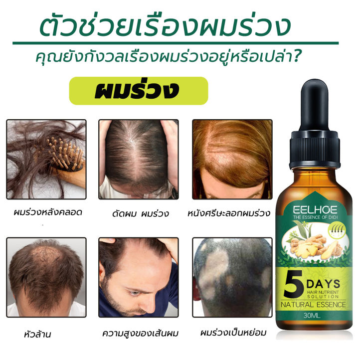 บอกลาหัวล้าน-eelhoe-เซรั่มปลูกผม-30มลส่งเสริมการเจริญเติบโตของเส้นผมตามธรรมชาติป้องกันผมร่วงแก้ปัญหาผมร่วง-น้ำยาปลูกผมชาย-น้ำยาเร่งผมยาว-น้ำยาปลูกผม-ยาปลูกผมของแท้-ยาปลูกผม-ปลูกผมเร่งด่วน-เซรั่มเรงผมย