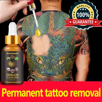 Shop Permanent Tattoo Removal Cream online  Lazadacomph