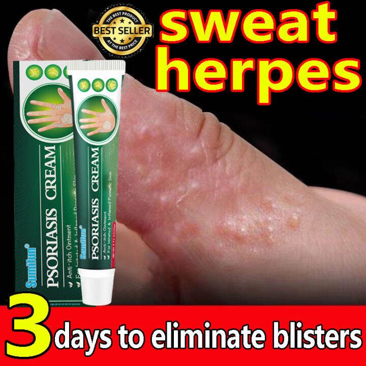 【SUMIFUN】herbal antibacterial cream Safe and no side effects psoriasis