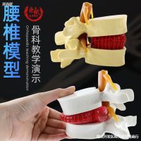 Lumbar amplification of lumbar compression demonstration model of human spine vertebra pathological joints medicine use