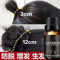 Original andrea hair growth hair growth liquid quickly grows long and prevents hair loss and increases hair density and develops hair liquid