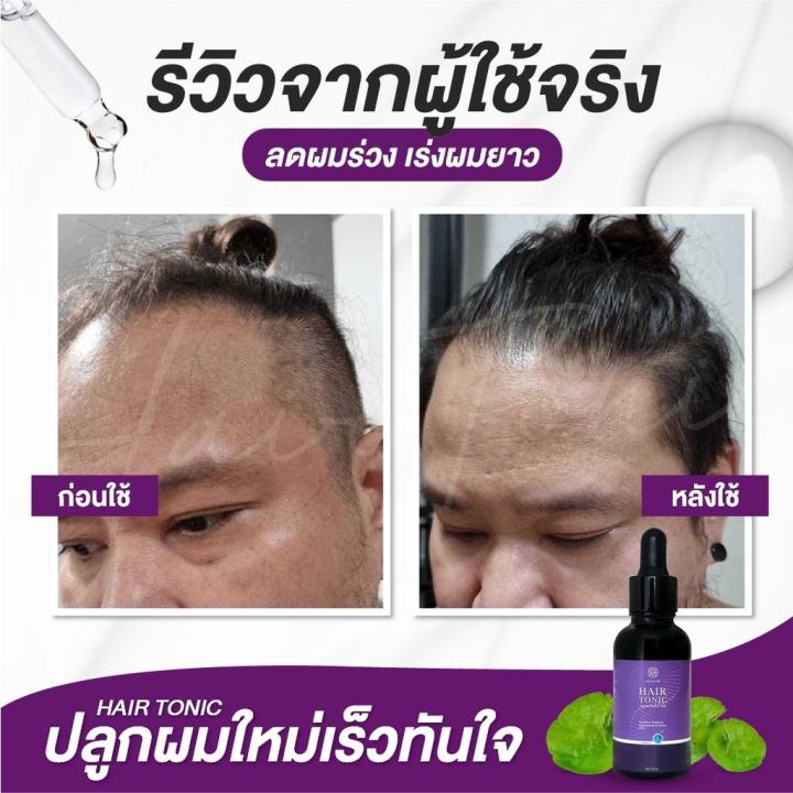 ส่งฟรี-เซรั่มบำรุงเส้นผม-chaba-1-แถม-1-แบบไม่ต้องล้างออก-บำรุงผมแห้งเสีย-แตกปลาย-ผมขาดร่วง-ฟื้นฟูผมให้กลับมาแข็งแรง