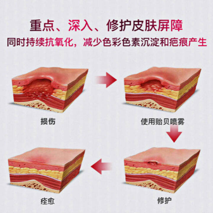 สเปรย์มิวซินของหอยแมลงภู่เพื่อขจัดริ้วเลือดแดงซ่อมแซมกล้ามเนื้อที่บอบบางซ่อมแซมฮอร์โมนป้องกันอาการคันและซ่อมแซมเอสเซนส์