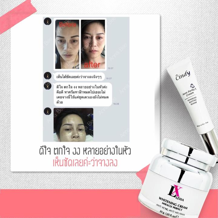 2-กระปุก-anna-bee-หน้าใสไร้สิว-ฝ้ากระ-lx-lexia-whitening-cream-30g