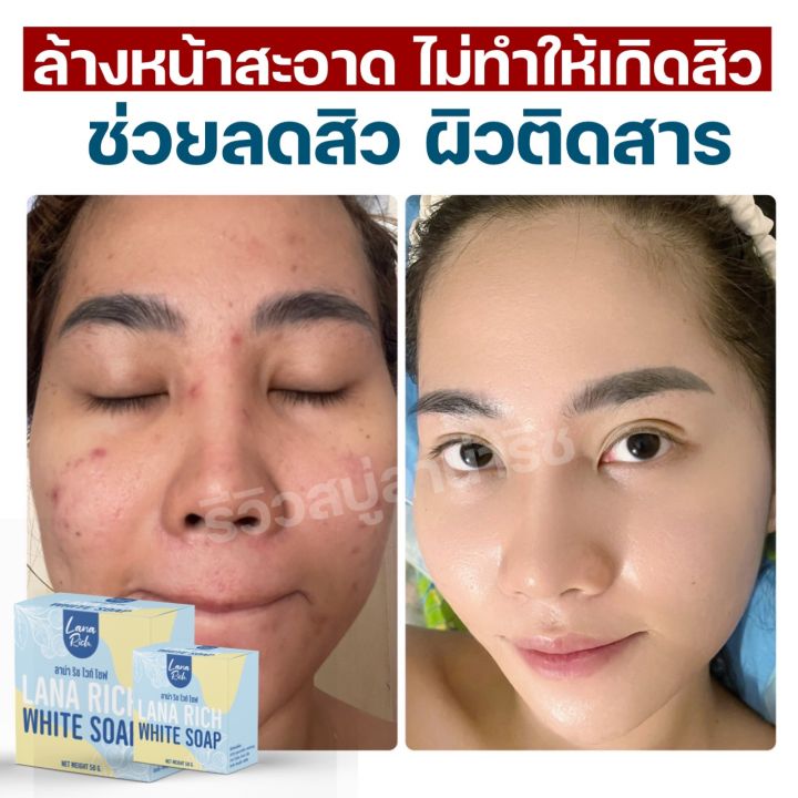 พร้อมส่ง-ครีมอาบูติน-สบู่ลาน่า-ริช-lana-rich-white-soap-ลา-น่า-ริช-เร่งขาว-ขาวเเรงง-สบู่ผิวตัว-ผสมอาร์บูติน-และ-กลูต้า-ลดรอยแตกลาย