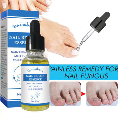 20ML Nail Fungus Repair Fluid Treatment Foot Care Essence Nail Foot Care Toe Nail Fungus Removal Gel Anti-Infective Paronychia