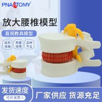 Simulation of the human body extrusion simulation demonstrate the spine amplification model of lumbar spine lesions bonesetting teaching