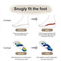 Vivinatural ญี่ปุ่นแบนเท้า Orthopedic Insole Flat Sole Support Part Foot Valgus Correction