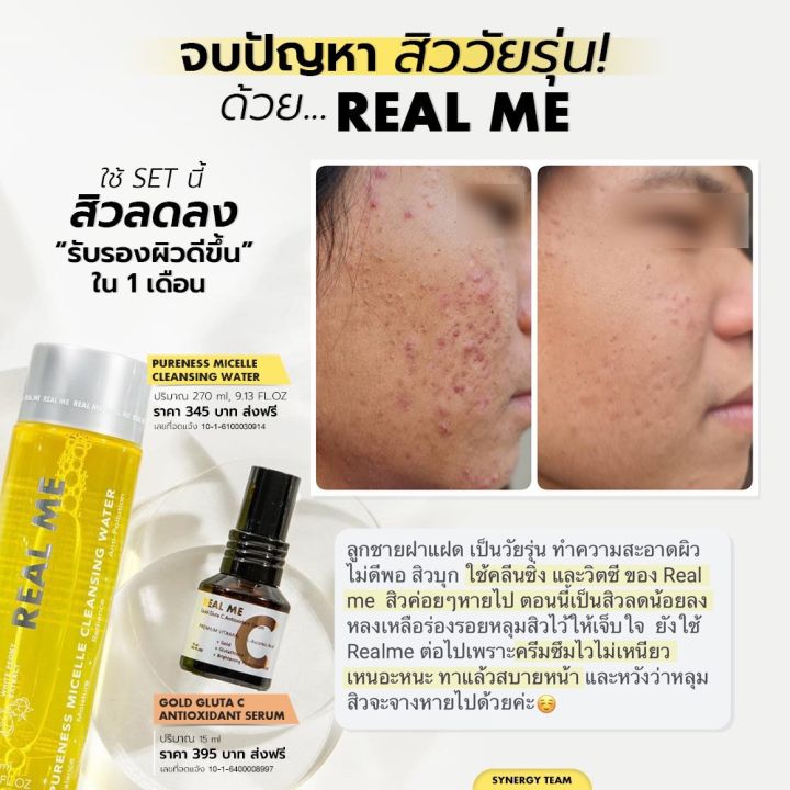 เซตคู่-คลีนซิ่ง-กลูต้า-ซ๊-ราคา-740-บาท-ลดสิว-หน้าใส-ไม่ว่าหน้าจะเจอปัญหาอะไรมา-cleansing-gluta-c-ของ-real-me-เรียลมี-เอาอยู่-เพื่อผิวที่แข็งแรง