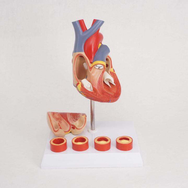PVC Life Size Human Heart Anatomy Model With 4 Stage Vascular Mounted