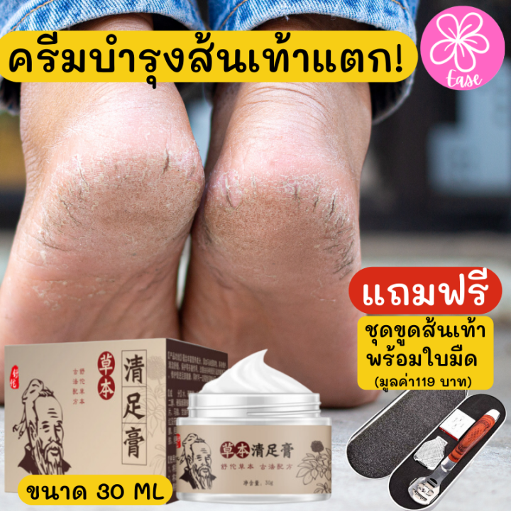 ซื้อครีม-แถมฟรี-ชุดขูดส้นเท้าแตกด้ามไม้-ครีมบำรุงส้นเท้าแตก-ครีมบำรุงเท้า-ครีมทาเท้า-ครีมทาส้นเท้า-ที่ขัดส้นแตก