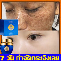 ครีมรักษาฝ้า 50g เลือนฝ้ากระฝังลึกและจุ บกพร่อง ปรับสีผิวให้กระจ่างใสขึ้น(ครีมทาแก้ฝ้า ครีมทาฝ้าหนาๆ ครีมกระไวท์เทนนิ่ง ครีมถหน้าขาว ครีมสลายฝ้า ครีมหน้าขาวใส ครีมฝ้ากระ  ครีมลดจุดด่างดำ